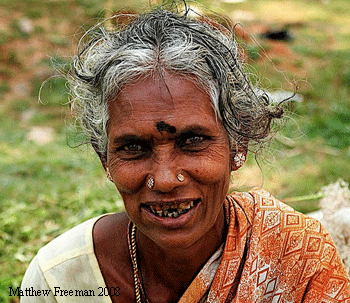 India teeth